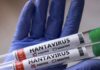Canadá eleva a seis el número de personas aisladas en el país por riesgo de hantavirus