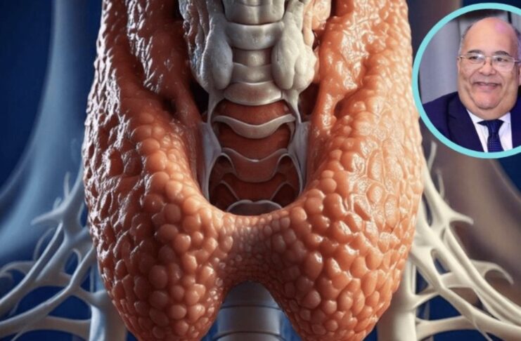 Endocrinólogos llaman a detectar a tiempo cáncer y enfermedades tiroideas