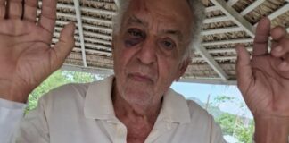 Delincuentes no temen persecución del Gobierno! DELINCUENTES ATACAN BRUTALMENTE A LORAINE CONOCIDO EMPRESARIO EN ALTAMIRA .